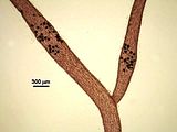 4 - Assi con tetrasporocisti